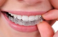 Una empresa argentina desarrolló una ortodoncia con tecnología 3D