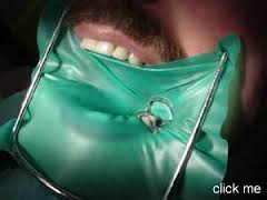 ¿por qué es cara la endodoncia?