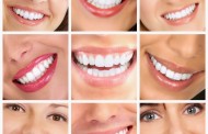 ¡No empañes la belleza de tu sonrisa! - Ortodoncia y Blanqueamiento
