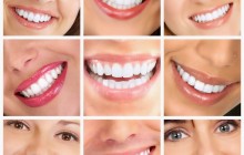 ¡No empañes la belleza de tu sonrisa! - Ortodoncia y Blanqueamiento