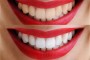 La importancia de escoger a un endodoncista certificado