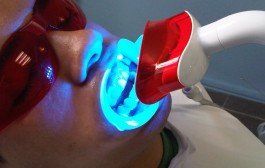 Recomendaciones para el blanqueamiento dental