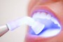 ¿Que es la maloclusión dentaria?