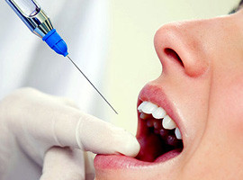 Anestesia dental
