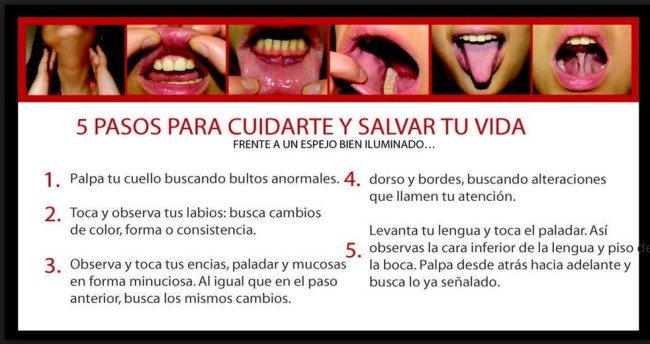 Prevencion cancer oral