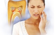 ¿Que es la hipersensibilidad dental?